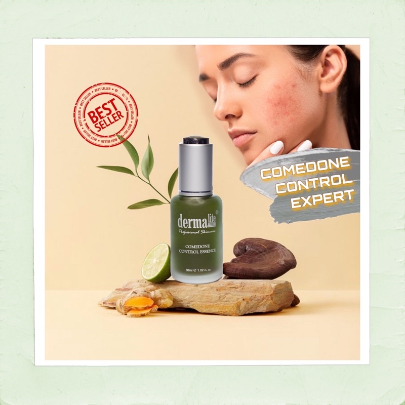 DERMALITE COMEDONE CONTROL ESSENCE SKIN SERUM 30ML / Eliminates ACNE , BLACKHEADS & WHITEHEADS