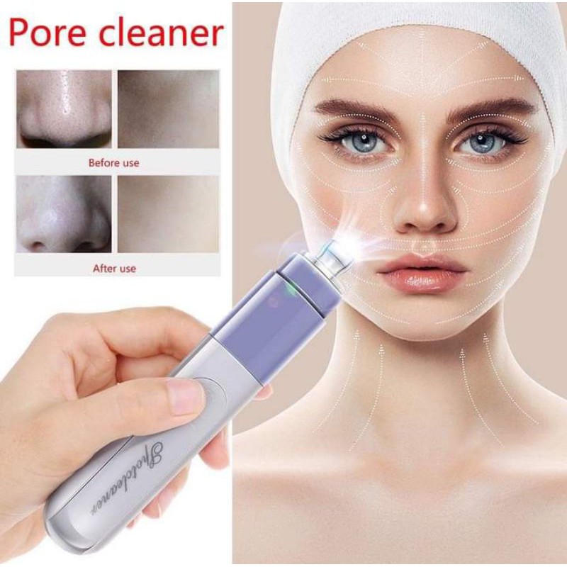 (Ready Stock) Remover Vacuum Facial Pore Cleanser Acne Comedone