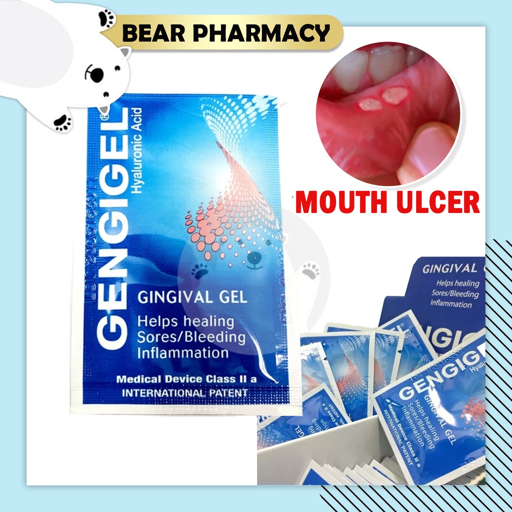 GENGIGEL Sachet 1ml 1 Pack/ 5 Packs [Exp 2025] Gingivitis, Gingival
