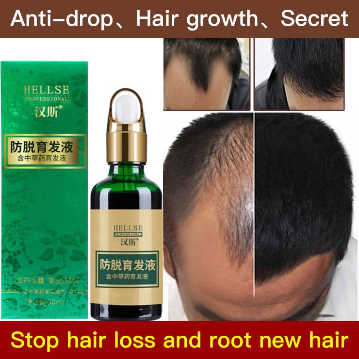 Polygonum multiflorum nutrient hair follicle black growth liquid
