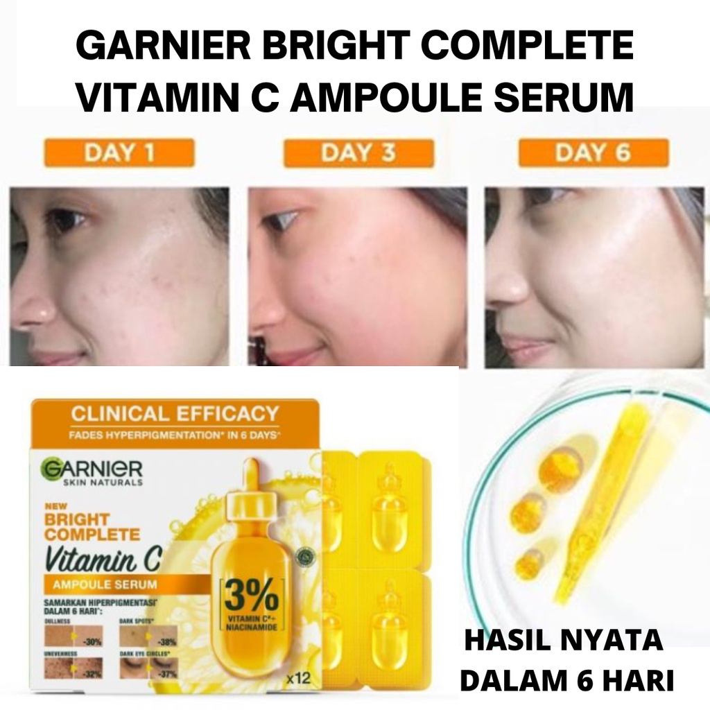 Garnier Bright Complete Ampoule Vitamin C Hyperpigmentation Serum Shopee Malaysia
