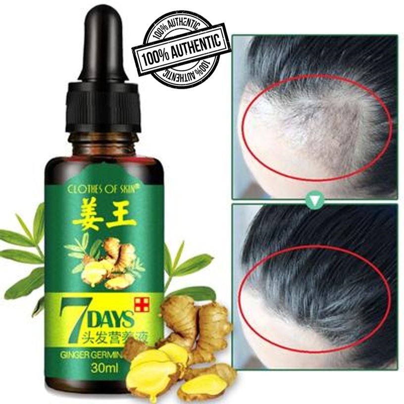 [100 AUTHENTIC] 30ml GINGER GERMINAL Essential Oil Hair Tonic Growth