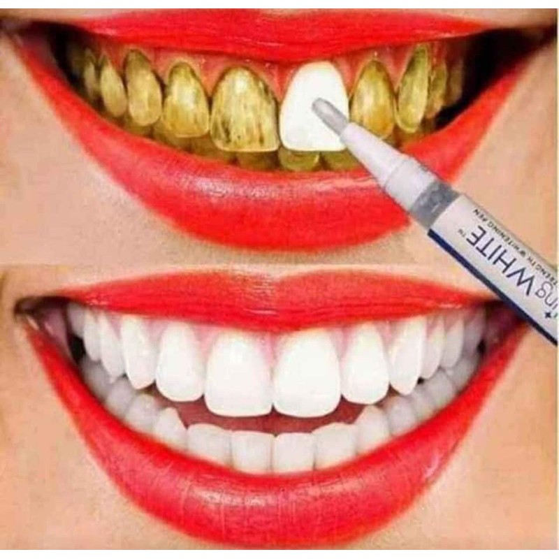 Teeth Whitening pen Dazzling white Putih gigi dengan cepat dan berkesan