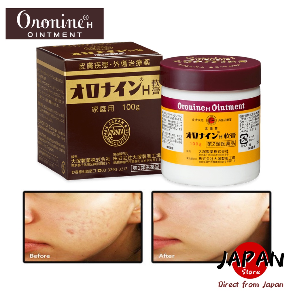 Oronine H Ointment Antibiotic / Acne Cream / Crack Skin, Eruptions