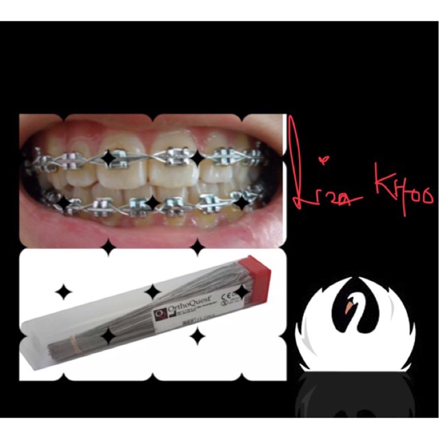 Long ligature wire (braces) Shopee Malaysia