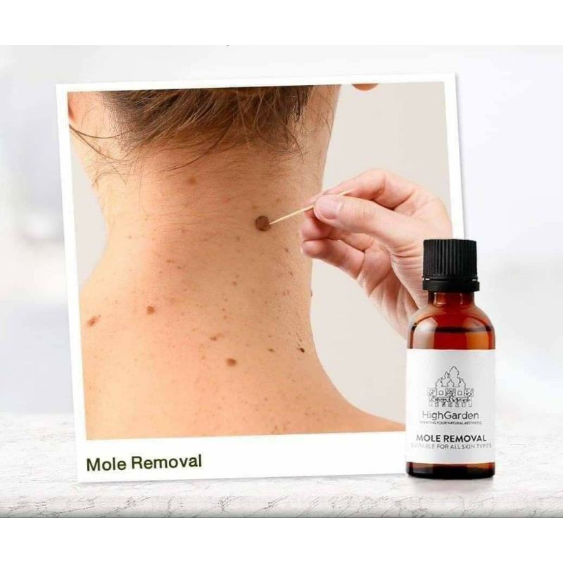 High Garden Mole Removal Offical Product (FDA APPROVED !) Shopee Malaysia