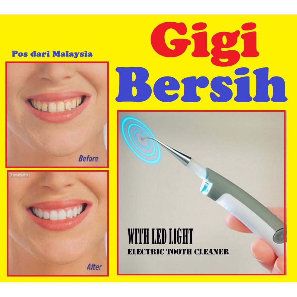 Alat Pembersih Pemutih Gigi Ultrasonic Dental Teeth Cleaner Cleaning