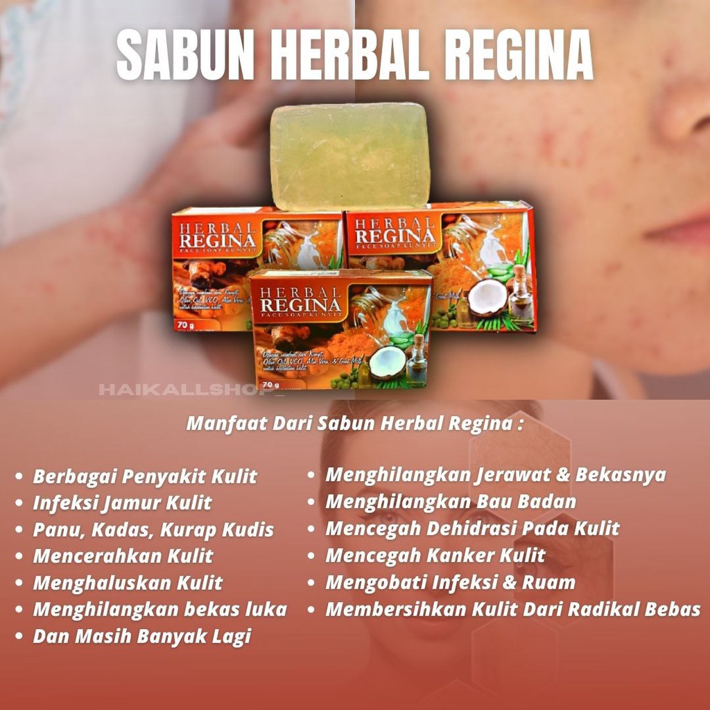 Herbal Soap Skin Itching, kudis, Panu, Kadas, Fungus, Fungus Soap