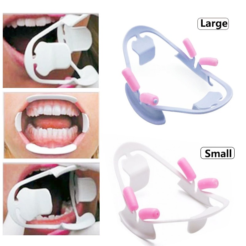 Dental Mouth Opener 3D Plastic Cheek Lip Retractor Large Small Dentist
