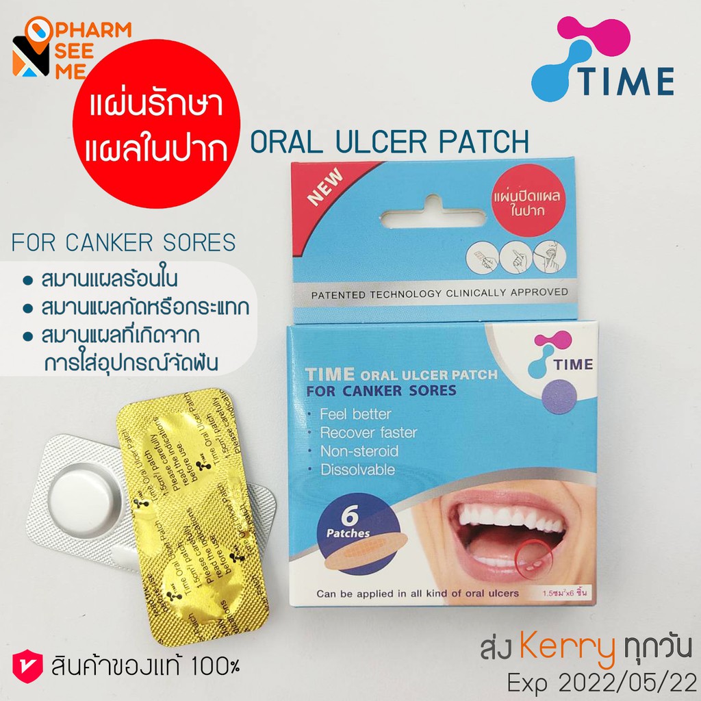 HOT PATCH IN TIME ORAL ULCER PATCH FOR CANKER SORES 6PCS Shopee Malaysia