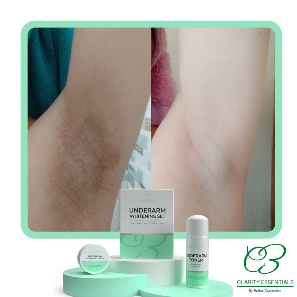 Underarm Whitening Set Whitening Toner and Underarm Whitening Cream