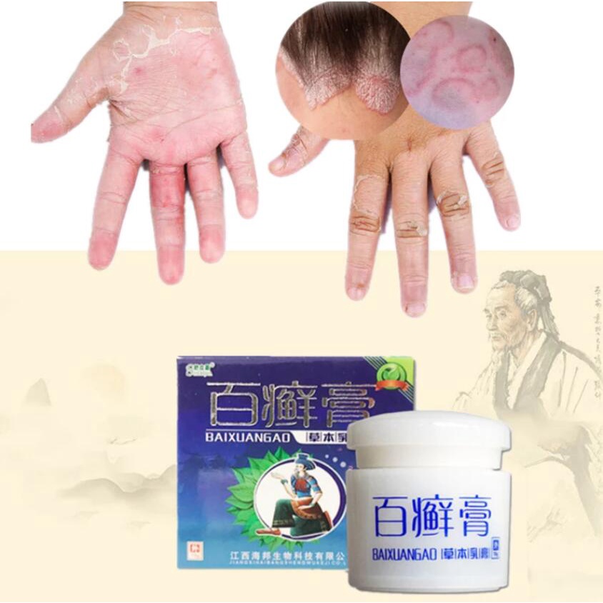 18g Ointment Herbal Treatment Skin Itching Antibacterial Tinea Pedis