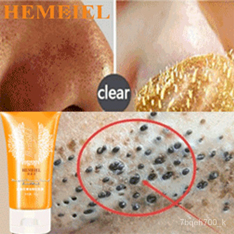 2022HEMEIEL Gold Black Heads Remover/Blackheads And White Heads Remover