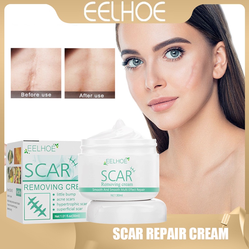 EELHOE Scar Repair Cream Remove Salt Burns Scars Treat Body Old Gel Postoperative AntiItch Skin