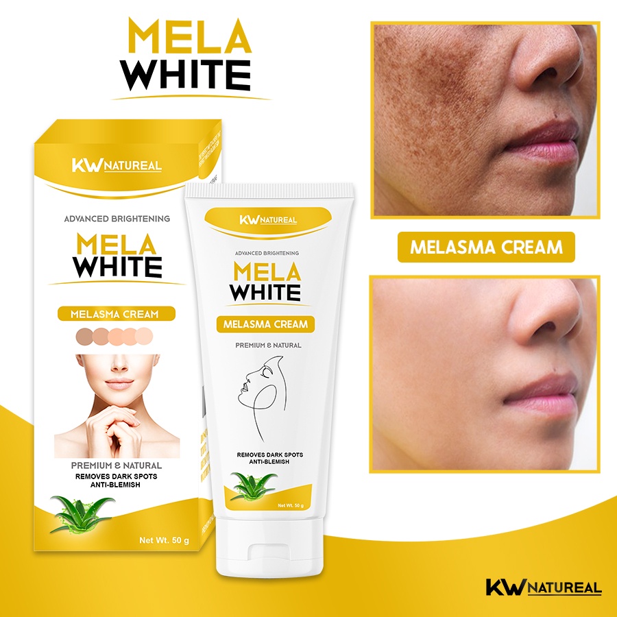 ORIGINAL MELAWHITE MELASMA CREAM, PEKAS, FRECKLE, MELASMA REMOVER