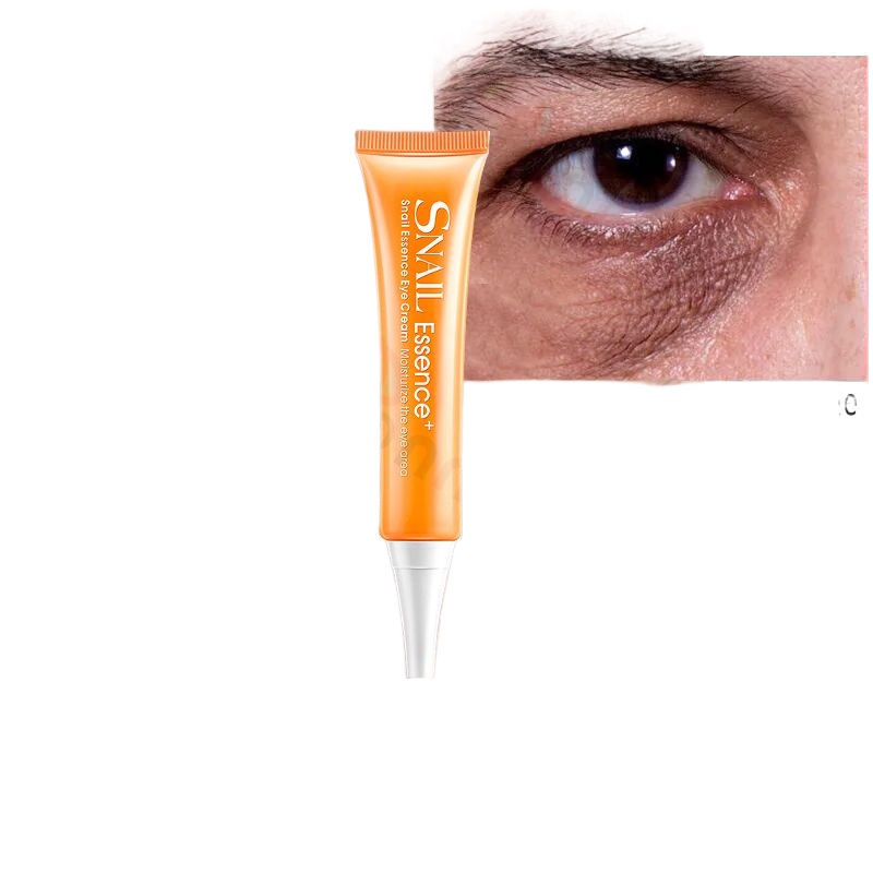 Support COD eye cream for dark circle eye cream eyebag remover eyebags