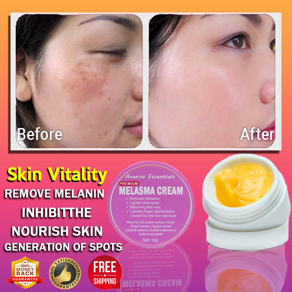 Original Melasma Pekas Sun & Dark Spots Remover Cream 10g (1 Jar With