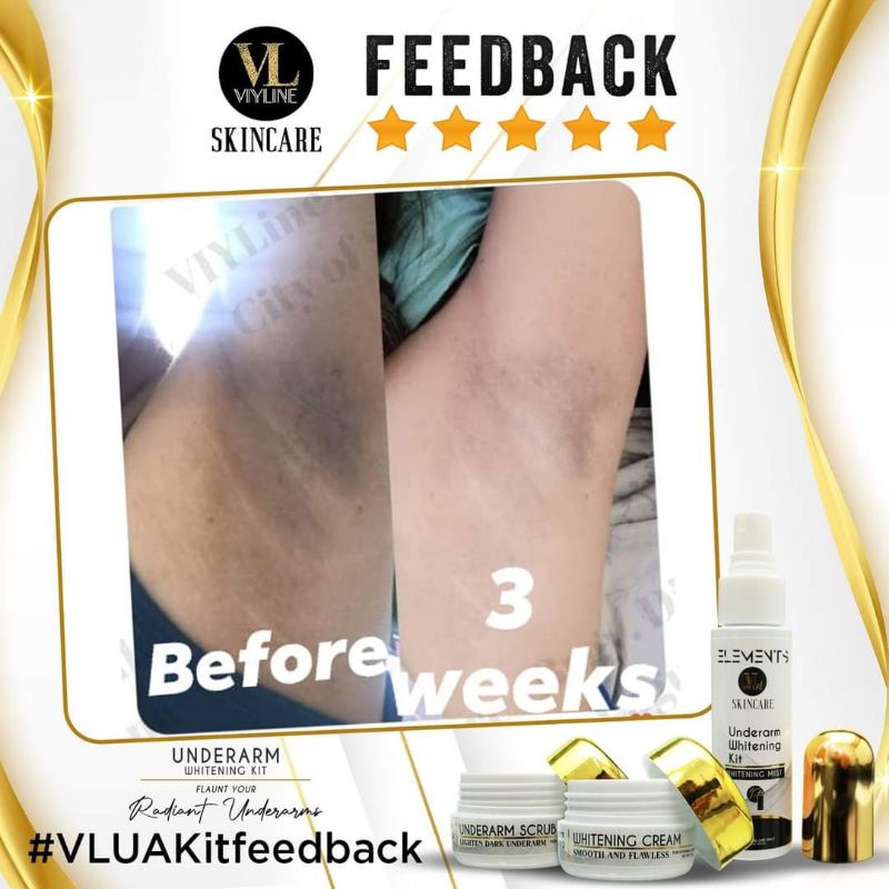 Viyline Skincare Underarm Whitening Kit Elements Shopee Philippines