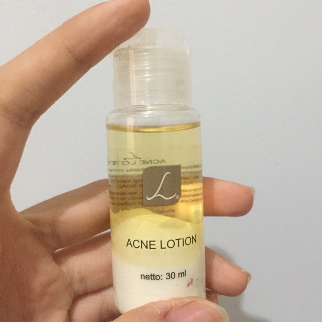 Larissa acne lotion sulfur 30ml Shopee Philippines