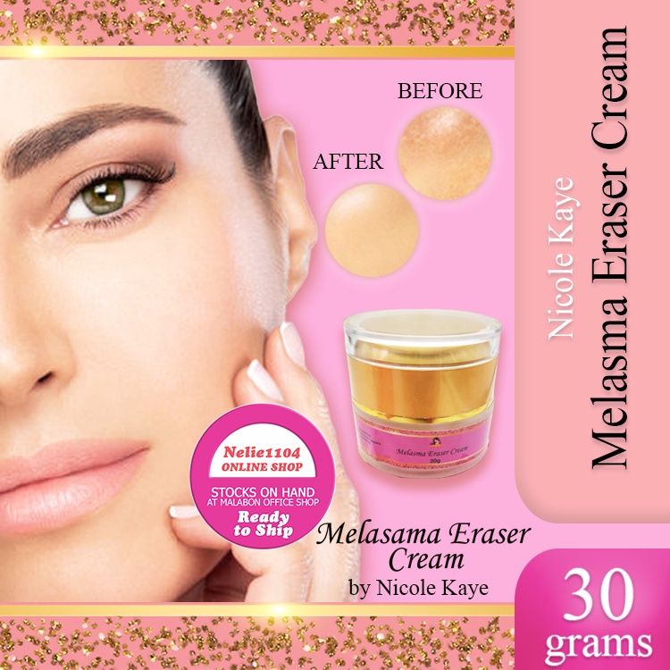 Nicole Kaye Melasma Eraser Cream 30g pekas remover pekas eraser