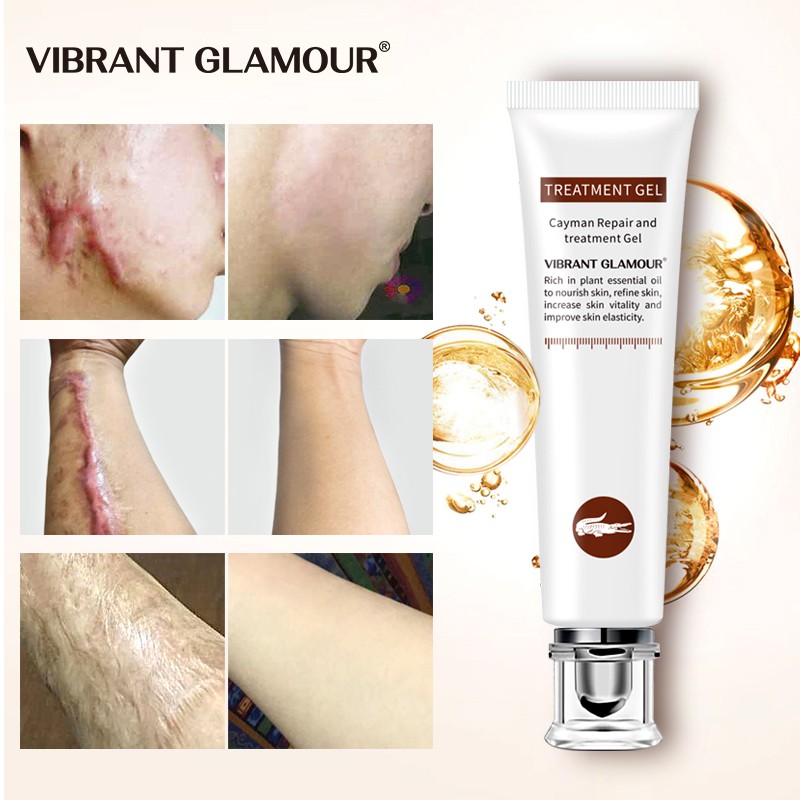 VIBRANT GLAMOUR Scar Remover Gel Repair Blackhead Acne Spots Acne Scar