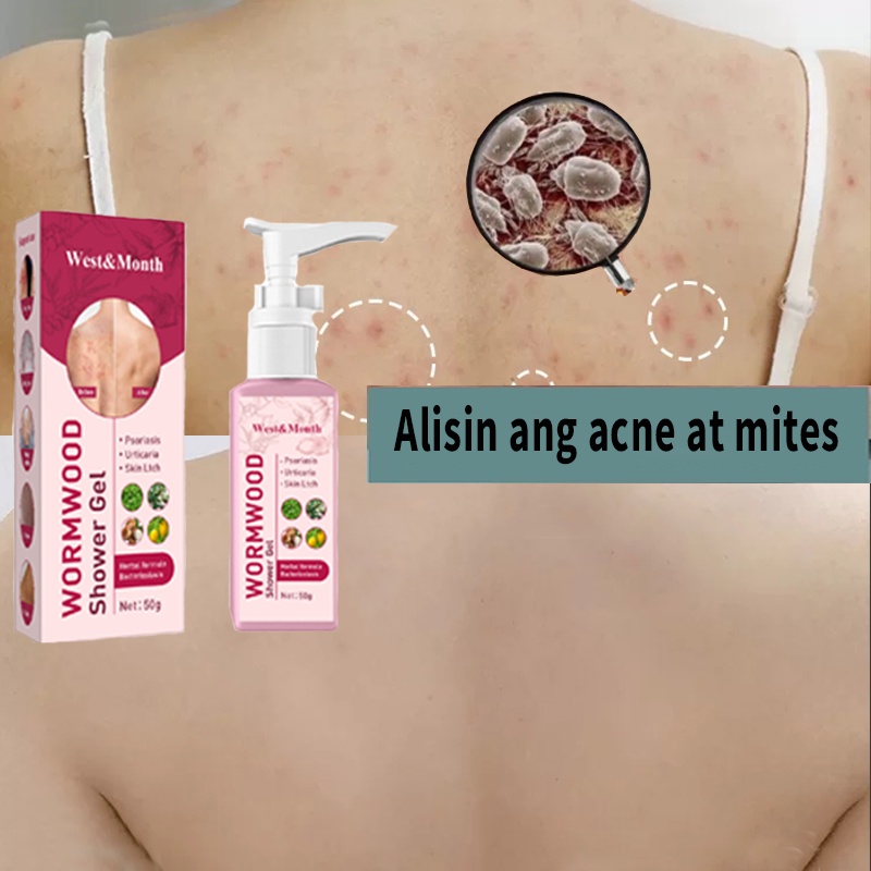 Acne Body Wash Whitening Body Wash Remove Mites Solve Dry Acne Skin