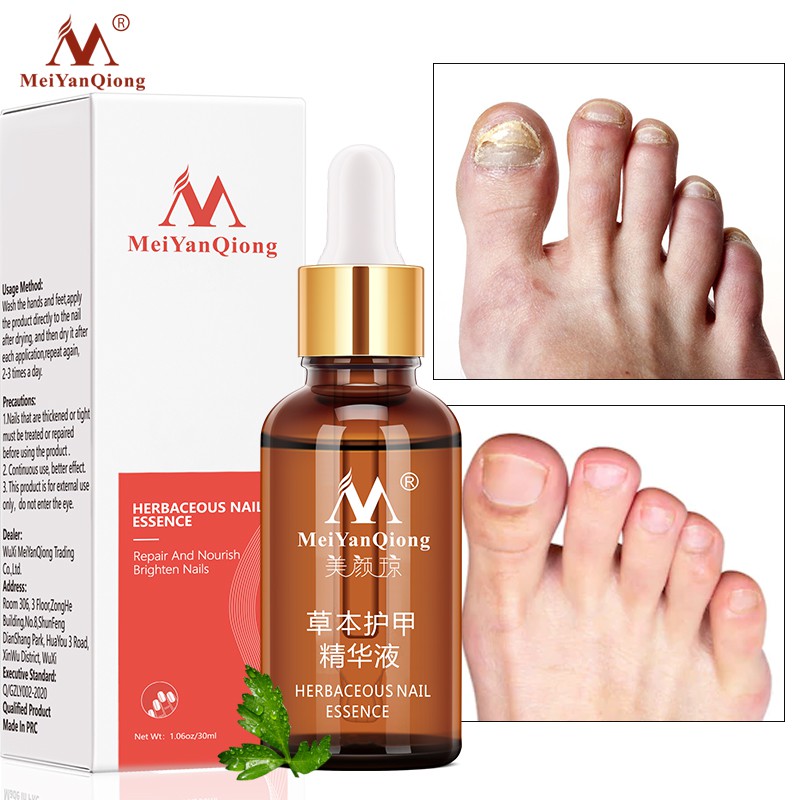 Nail Fungal Treatment Feet Care Essence Against Oils Fungus Rem 【一部予約販売中】