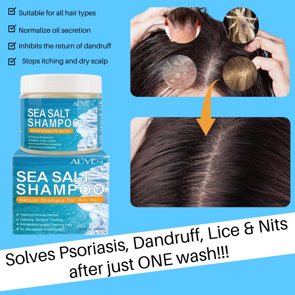 1 ALIVER Sea Salt Best Anti Dandruff Itching Heavy Flake Psoriasis