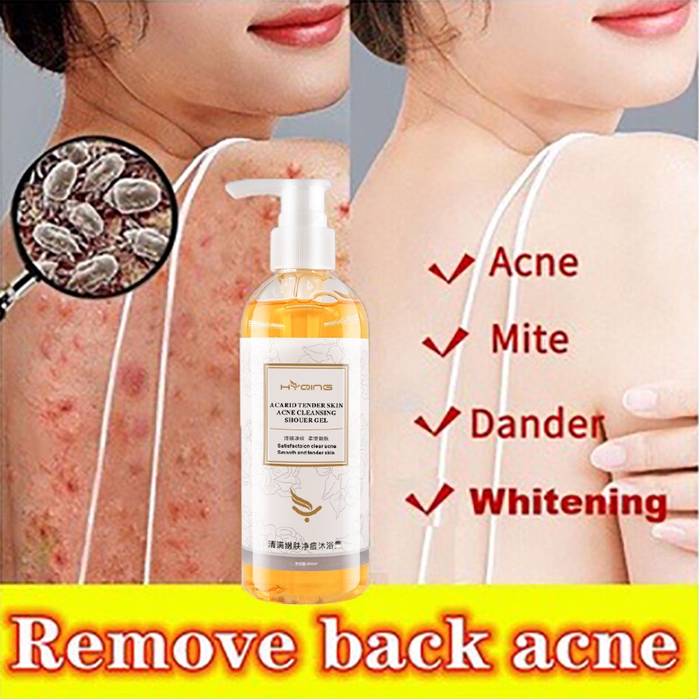 COD AntiMite Acne Shower Gel Body Wash Male Lady Body Wash