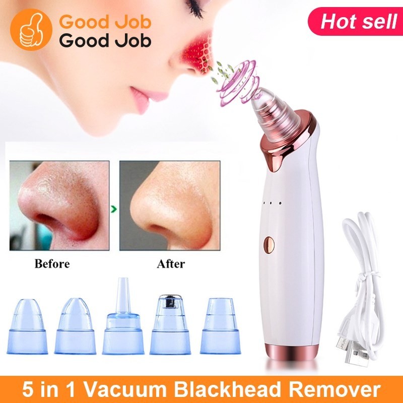5 Tips Remove blackheads remove pores acne vacuum suction facial beauty
