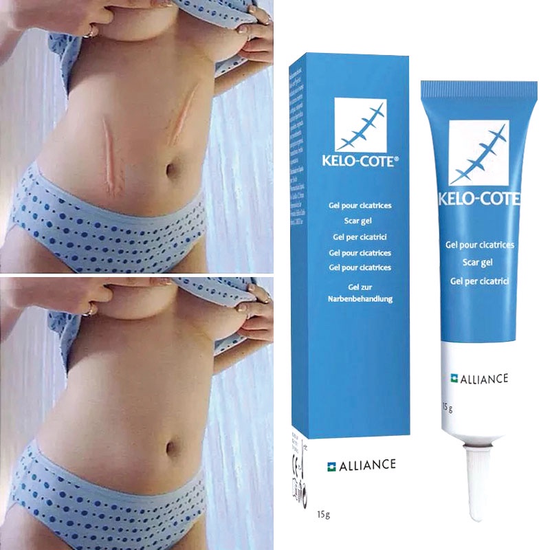 Kelocote Silicone Gel surgical scar repair gel 15g Moisturizer scar