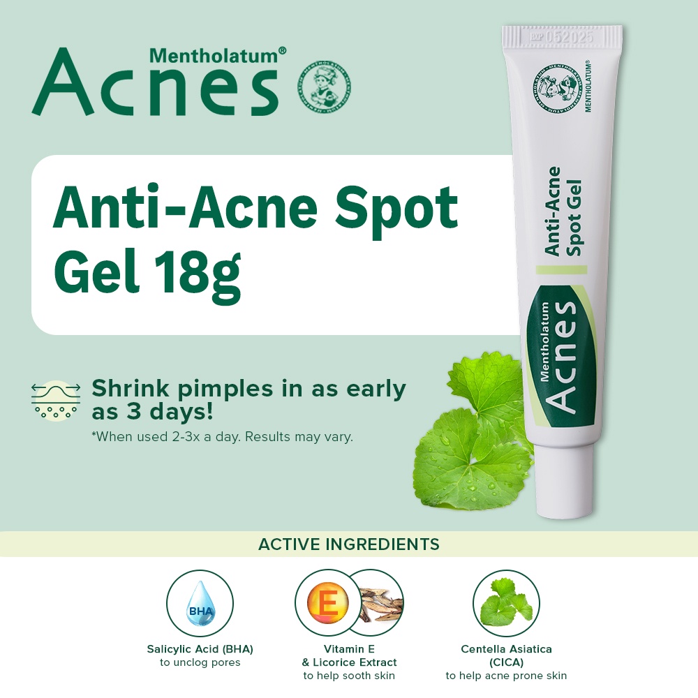 Acnes AntiAcne Spot Gel 18g Anti Acne, Spot Gel, Acne Marks, Spot