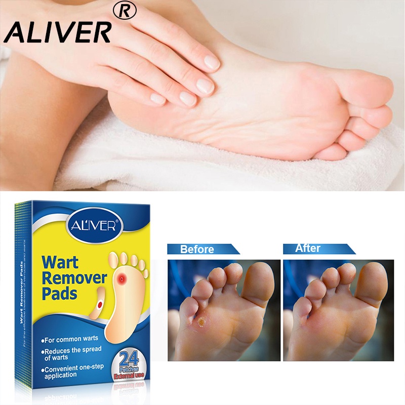 Plaster eliminates warts and corns, 24 sheets, foot helping, warts, warts, warts, warts, warts