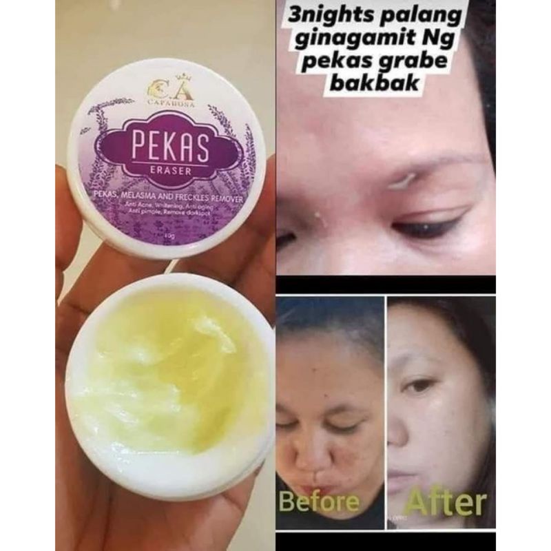 Authentic Pekas Eraser Cream by Capadosa Shopee Philippines