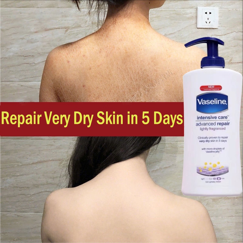 VASELINE Intensive Care Body Lotion Advanced Repair for Dry Skin Deep