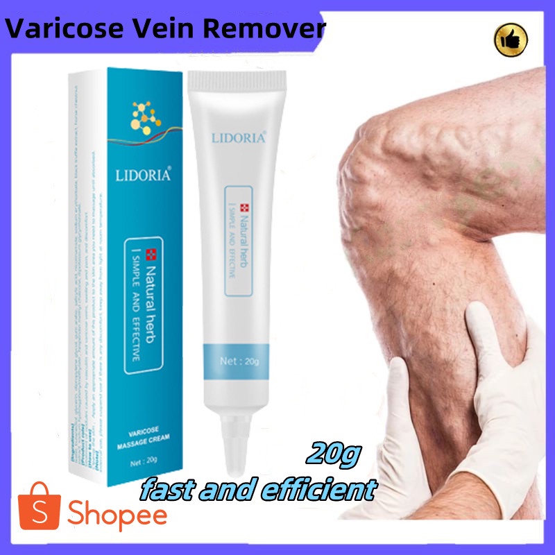 Hot Sale Varicose Vein Remover Cream Effective Original Varicose Veins