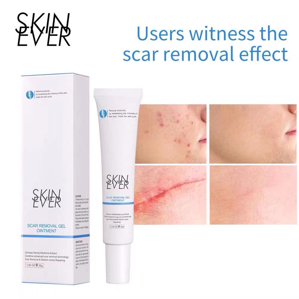 Skinever Surgical scars, stretch marks, scars from herbal injuries for