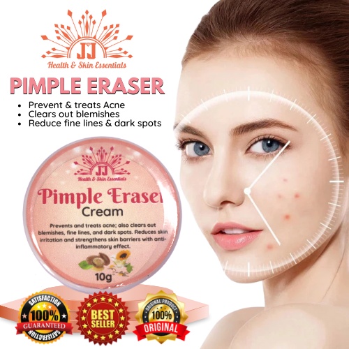 JJ Pimple Eraser Cream 10g Shopee Philippines