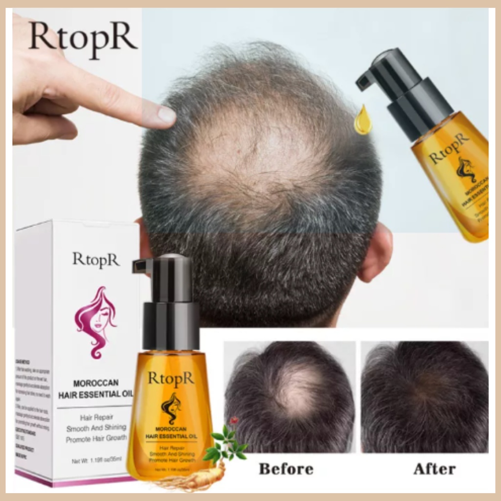 AUTHENTIC RtopR Moroccan Pure Argan Oil Hair Essential Oil For Dry