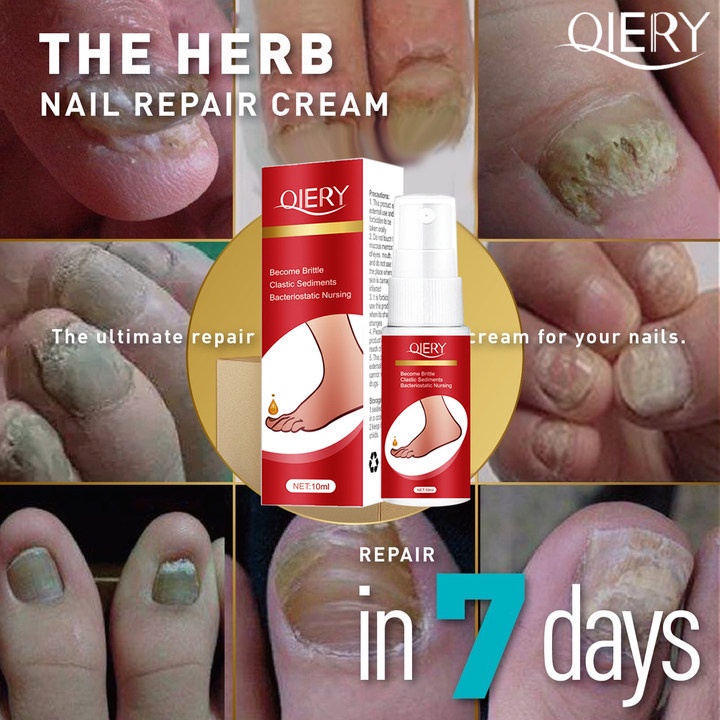 Nail Fungus Repair Spray Anti Fungal Ointement Damaged Nails Softening