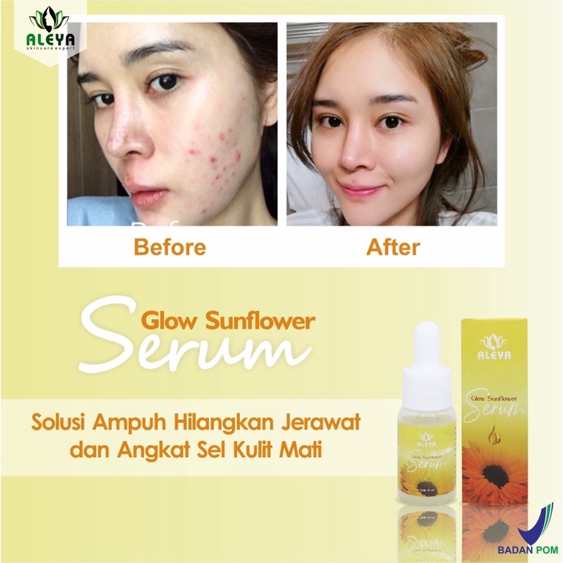 Peeling Gel Charchoal Facial Treatment Whitening Facial Soap Face Soap