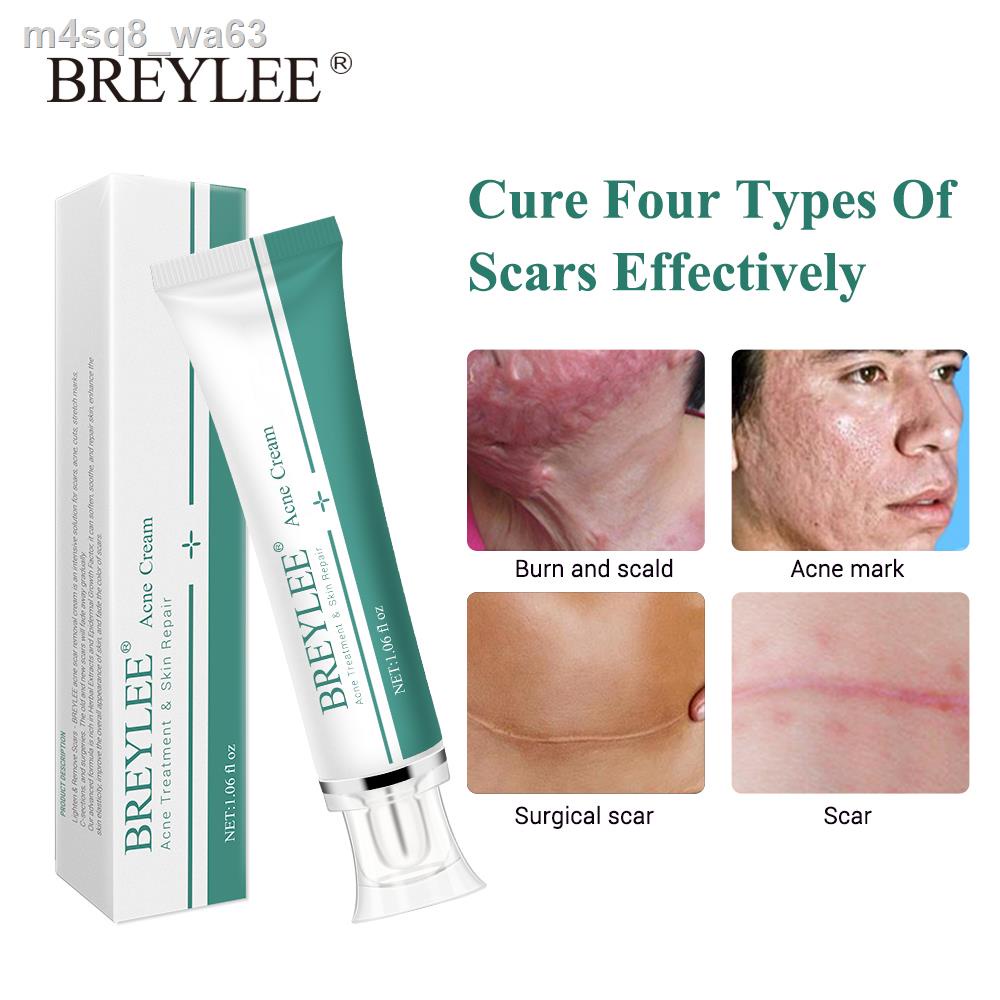 BREYLEE Scar Removal Cream 30g Acne Scar Remover Anti Acne Repair