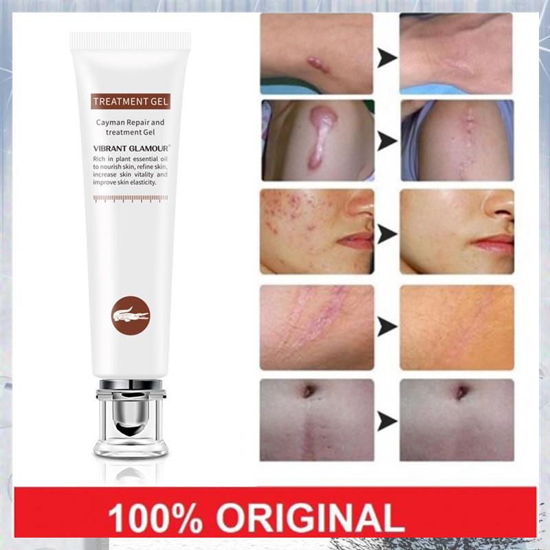 HOT Scar Remover Cream Scars Repair Stretch Marks Pregnancy Scars