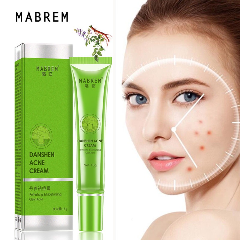 Effective Acne Removal Whitening Cream Acne Treatment Fade Acne Spots