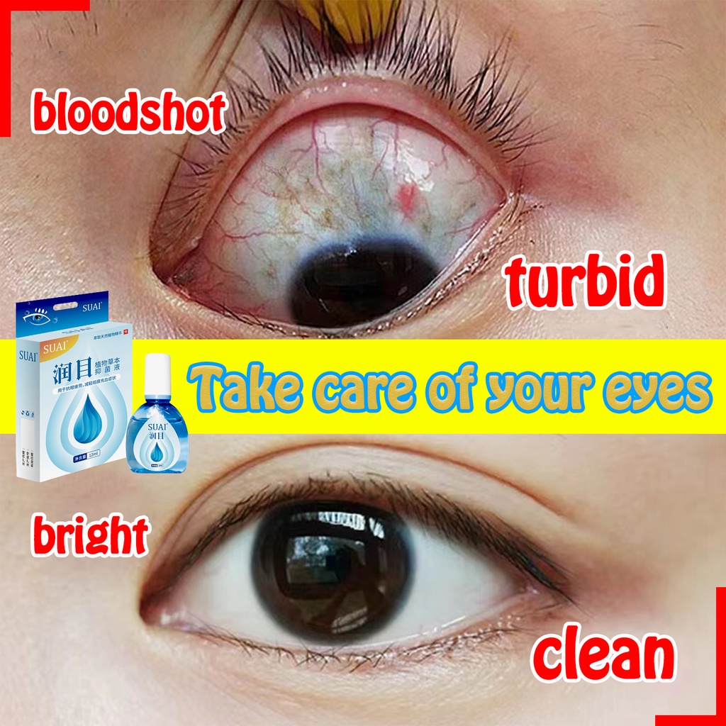 15ml Authentic itchy PugitaEye drops Dry EyesEyedrops