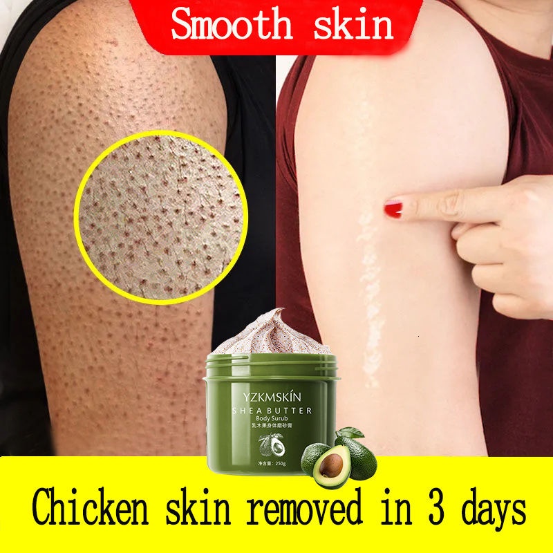 Niacinamide Shea Butter Body Scrub Chicken Skin Removal Dead Skin