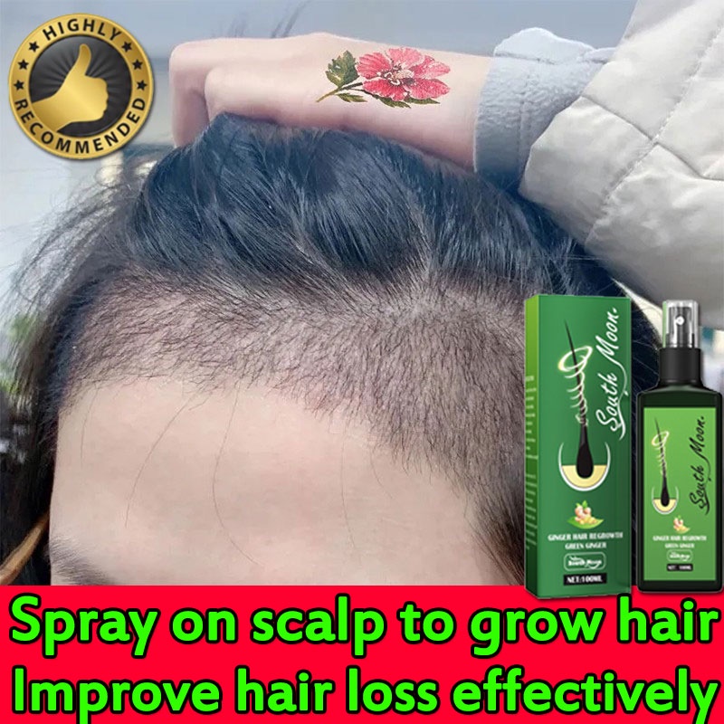Hair Growth liquid Promote hair regeneration(Hair Grower Anti Hair Loss