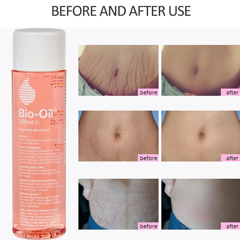 BioOil Skincare for Scar Stretch Mark Treatment Oil Scar Removal Gel Cream Repairs Stretch