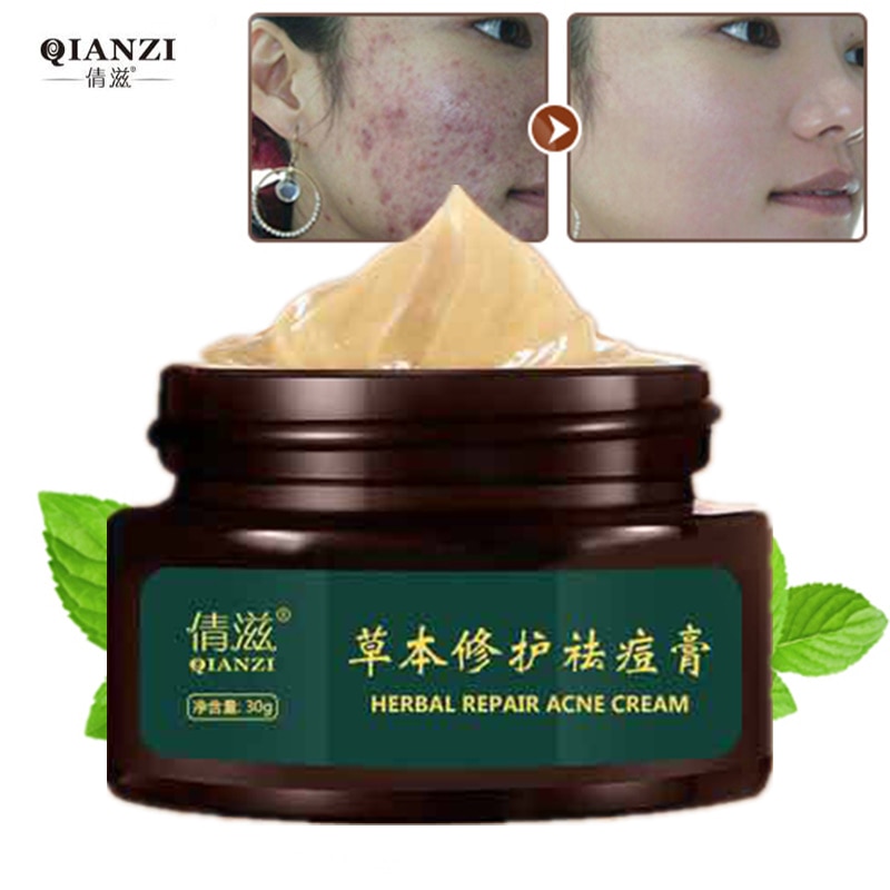 Herbal Acne Cream Anti Pimple Spot Acne Scars Blackhead Removal Cream