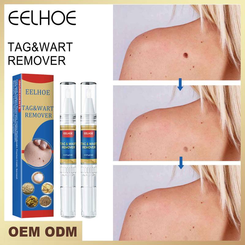 Eelhoe Mole Removal Pen Anti Verruca Remedy Mole Wart Remover Spot Body